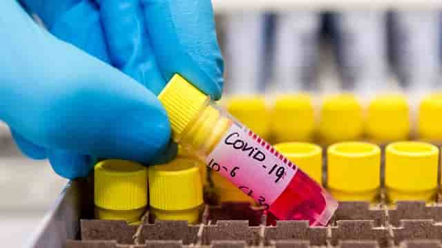 Covid-19 y Las Tunas: quinto caso importado en agosto